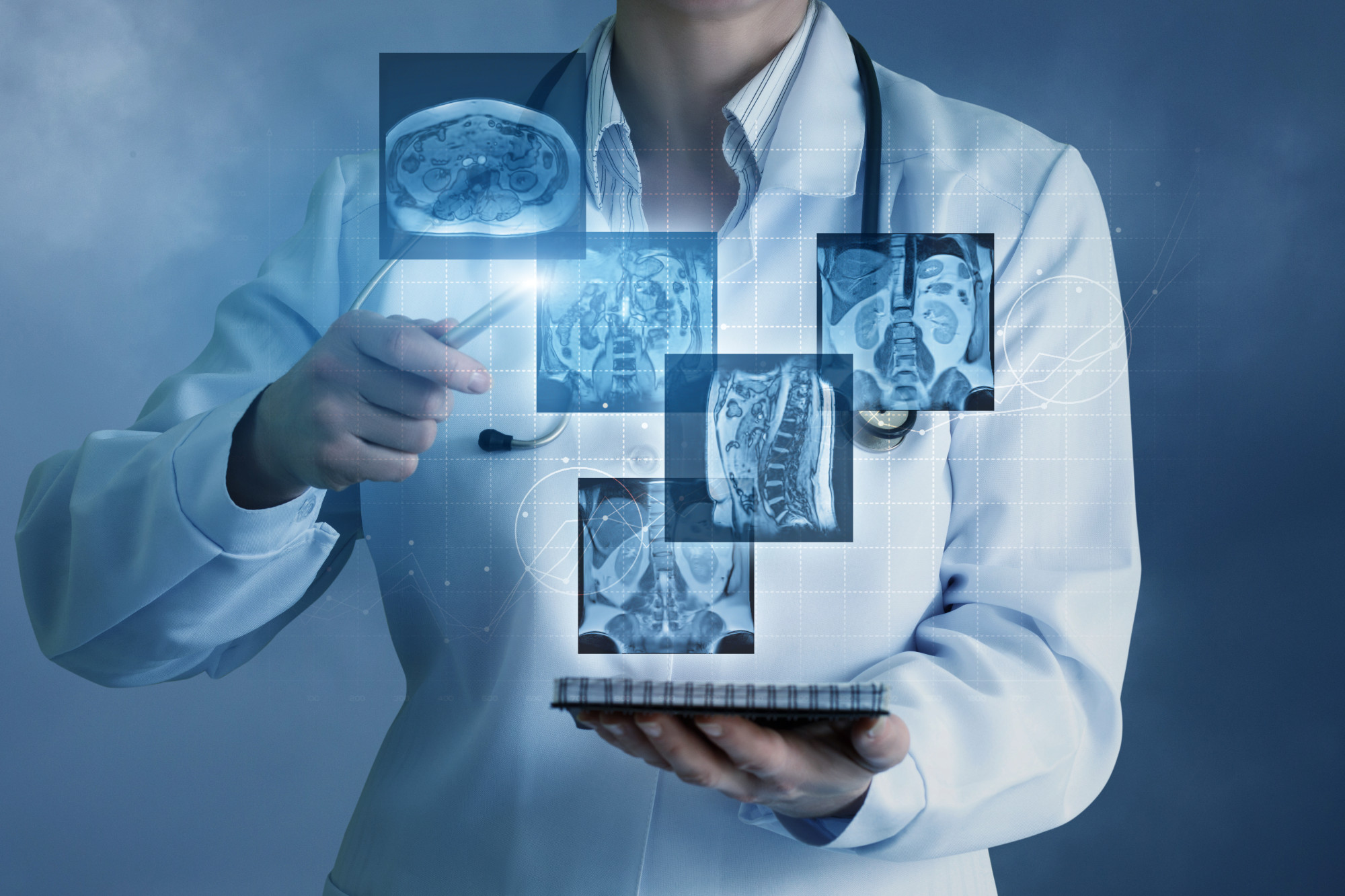A healthcare professional in a white lab coat holds a digital tablet while pointing at floating medical imaging scans. The scans include brain and spine images, with a technological background suggesting advanced medical diagnostics.